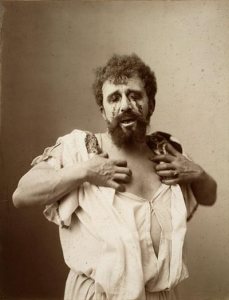 oedipus